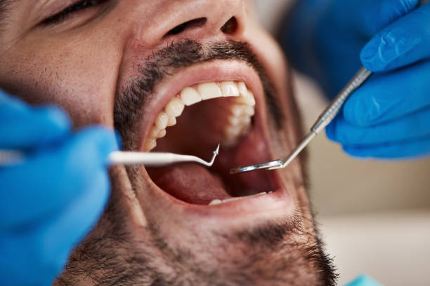 Best Tooth Extraction  in Macedonia, OH
