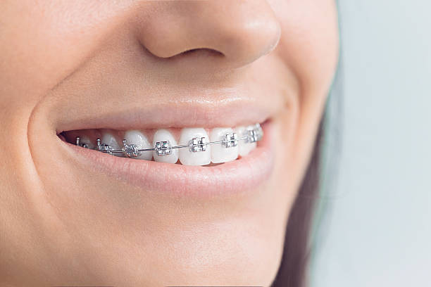 Dental Inlays and Onlays in Macedonia, OH